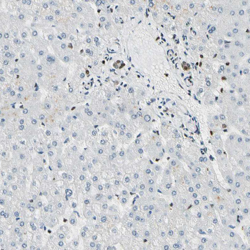 Immunohistochemical staining of human liver shows moderate nuclear positivity in bile duct cells while hepatocytes are negative.