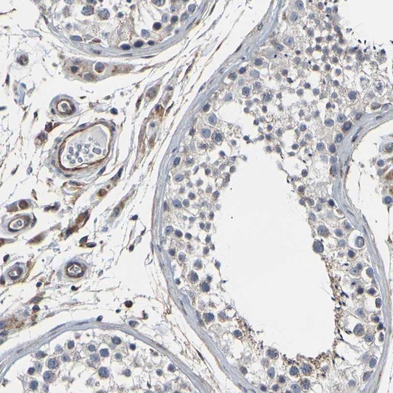 Immunohistochemical staining of human testis shows low expression as expected.