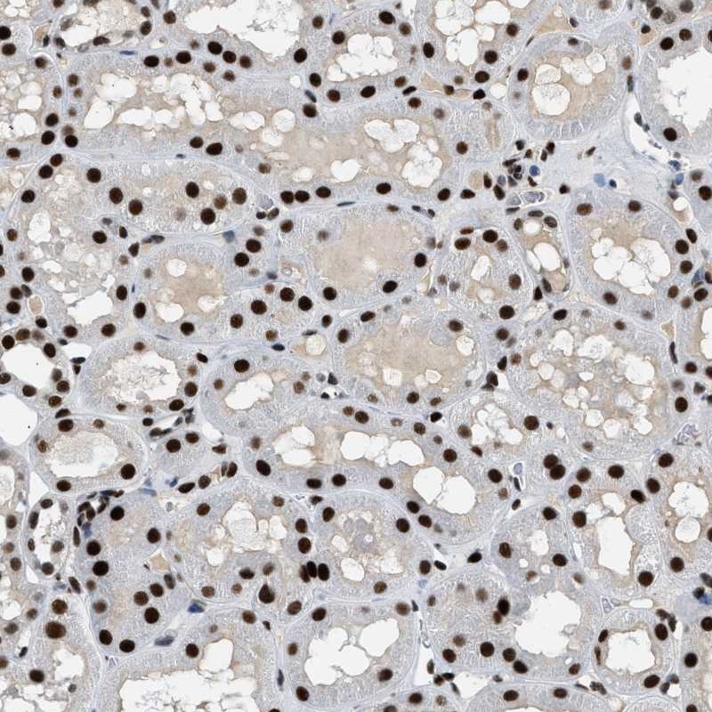 Immunohistochemical staining of human kidney shows strong nuclear positivity in tubular cells.