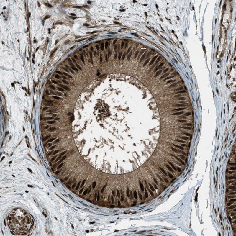 Immunohistochemical staining of human epididymis shows distinct positivity in both nuclei and cytoplasm of glandular cells.