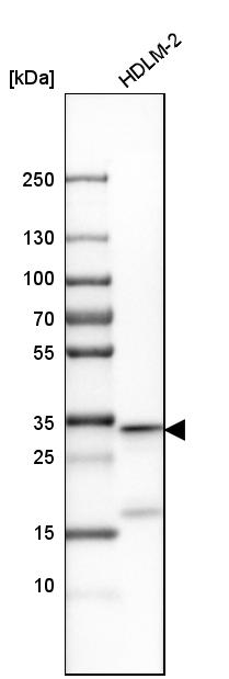 Western blot analysis in human cell line HDLM-2.