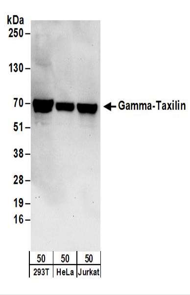 抗Gamma-Taxilin抗体の使用例画像