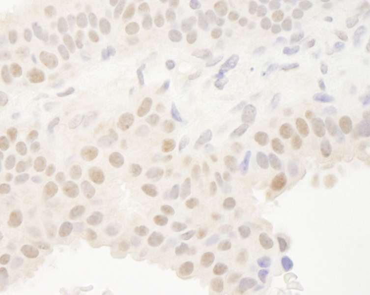 抗DEC1 IHC抗体の使用例画像