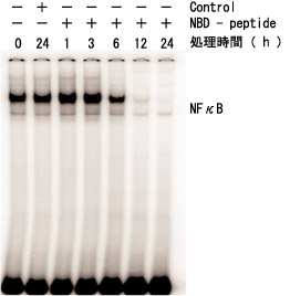 U266 細胞のゲルシフトアッセイ解析でNFκB 活性化が阻害されている
