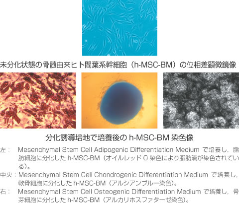 間葉系幹細胞 Mesenchymal Stem Cell 