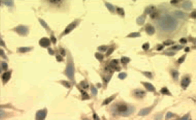 ヒートショックを与えたマウスメラノーマ細胞の写真