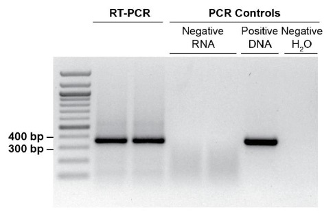精製したArthrobacter属のtotal RNA