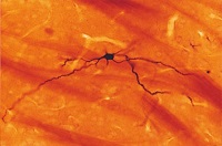 神経細胞染色用トレーサー