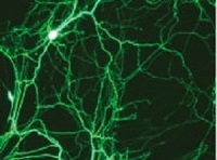 磁性粒子を用いた神経細胞用トランスフェクション試薬