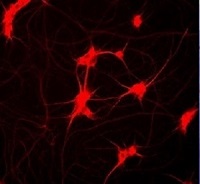 神経前駆細胞を迅速に成熟させるサプリメント