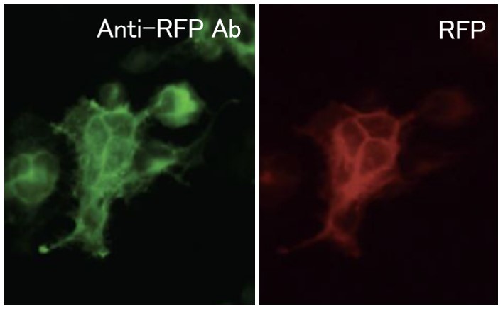 RFP抗体免疫蛍光染色使用例
