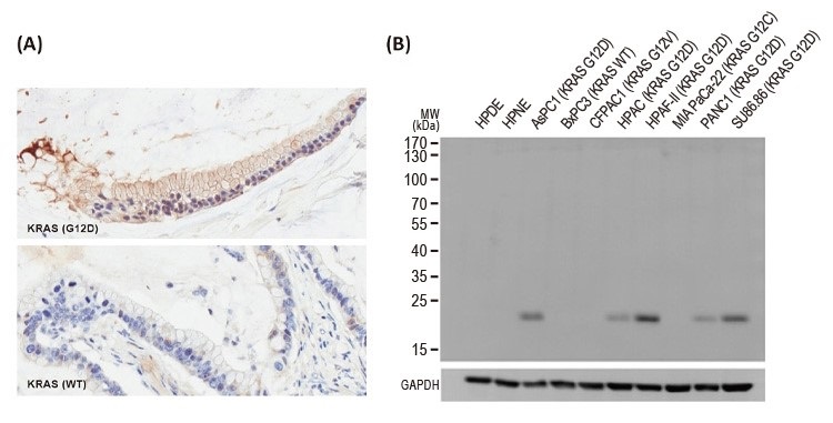 抗RAS（G12D Mutant）組換えウサギモノクローナル抗体の使用例