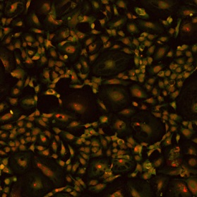 図5. VitroGel AAKハイドロゲル上におけるHUVEC細胞の増殖
