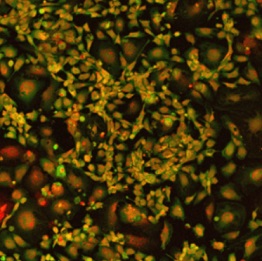 図11. VitroGel AAK-HCハイドロゲル上におけるHUVEC細胞の増殖