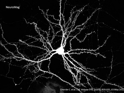 GFPを発現するマウス皮質神経細胞（培養3週間後、マグネットフェクション後2～3日）
