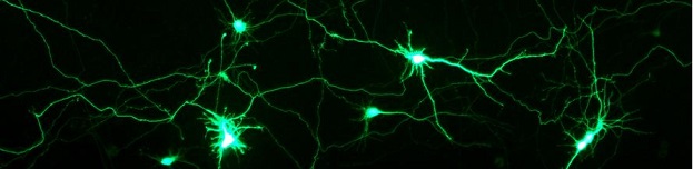 NeuroMagでトランスフェクションを行ったラット海馬初代神経細胞