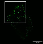 HeLa細胞蛍光画像