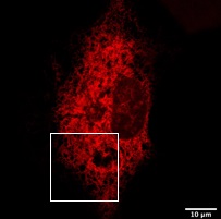 赤色蛍光タンパク質（ER-mKO1）発現ER蛍光画像