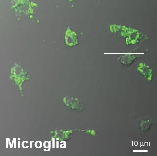 二光子顕微鏡によるミクログリアの観察"