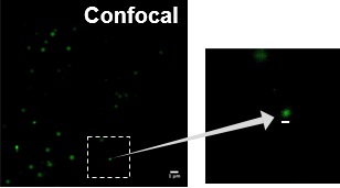STED超高解像度顕微鏡による微小脂肪滴の可視化（共焦点レーザー顕微鏡観察）