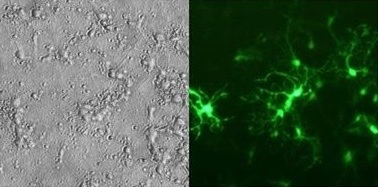 初代ラット皮質ニューロン：jetMESSENGER - eGFP mRNA