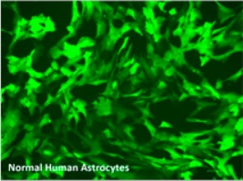 Normal Human Astrocytes