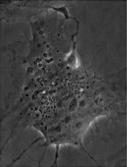 Particulate Thermoprobeをインジェクションした生細胞（COS7細胞）の位相差顕微鏡像