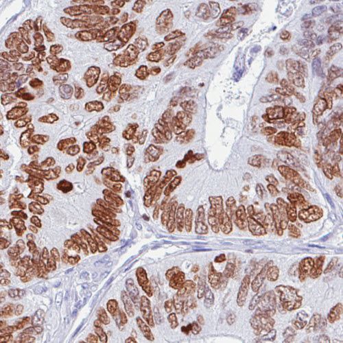 がん関連バイオマーカーに対する抗体各種バイオマーカー抗体