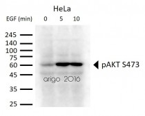 Phospho-AKT Antibody Duo (pS473, pT308) の使用例1