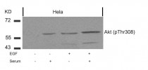 Phospho-AKT Antibody Duo (pS473, pT308) の使用例2
