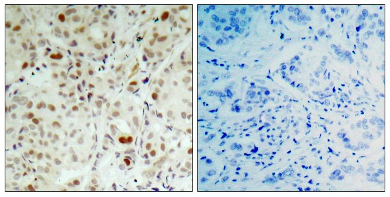 抗Rb1 / Retinoblastoma protein phospho (Ser807) 抗体（#ARG51632）を用いた免疫組織染色像