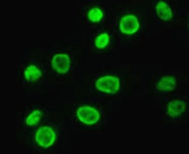 抗p21抗体（#ARG57928）を用いた免疫細胞染色（IC/IF）像