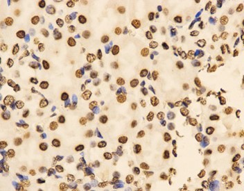 抗Histone H3 dimethyl (Lys9) 抗体（#ARG54763）を用いた免疫組織染色像