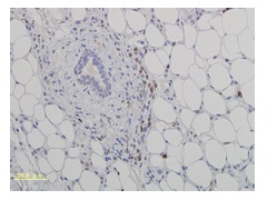 MMP-9（マウス腫瘍）免疫染色