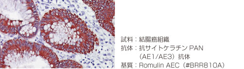結腸癌 Romulin AEC #BRR810A  