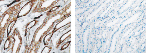 ABC法とMACH 1を用いた腎臓組織のネガティブコントロール染色