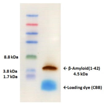 β-Amyloid(1-42)検出実験