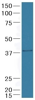 抗CDK7抗体