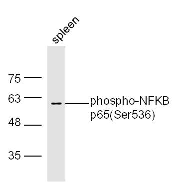 抗NFKB抗体の使用例