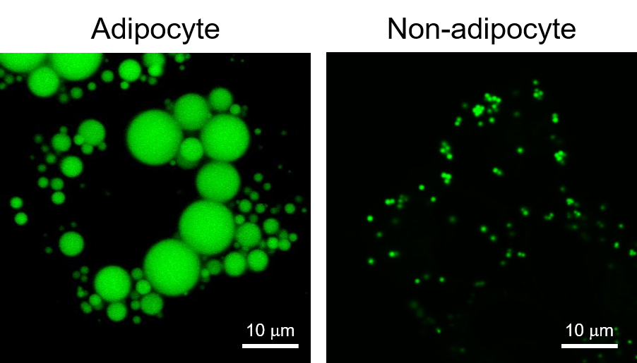 LipiDyeⅡによる脂肪細胞および非脂肪細胞の染色例
