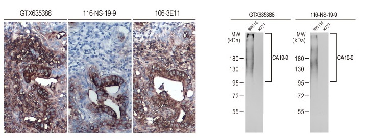 CA19-9 antibody (#GTX635388)のIHCとWB