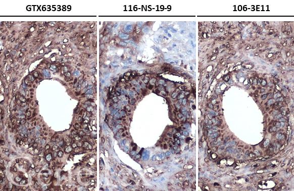抗CA19-9マウスモノクローナル抗体 [クローン：GT933]の免疫組織染色