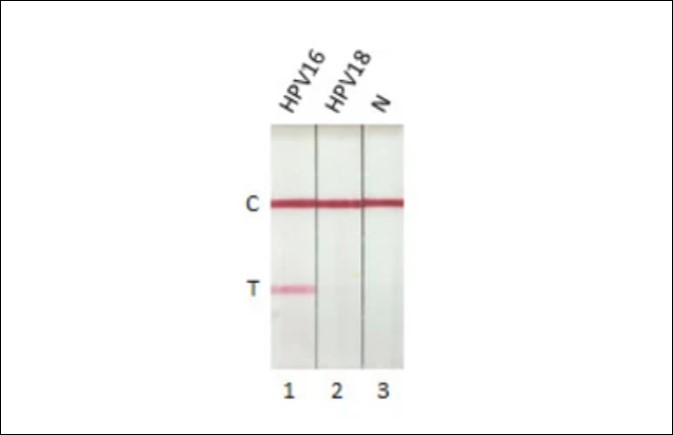 Human Papillomavirus type 16E7 protein by lateral flow assay