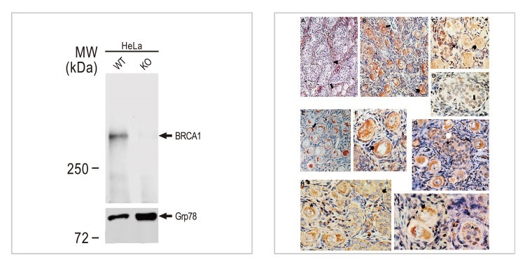 BRCA1 antibody (#GTX70111)のWBとIHC