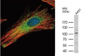 抗LAMP2抗体（#GTX103214）蛍光染色像とWB像