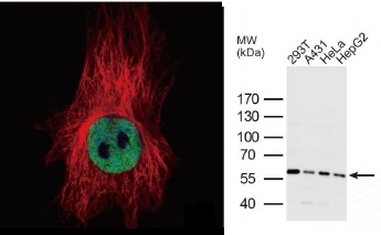 抗HDAC2抗体（#GTX109642）蛍光染色像とWB像