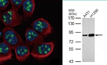 抗PAF49抗体（#GTX102175）蛍光染色像とWB像