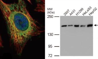 EEA1抗体（#GTX109638）蛍光染色像とWB像