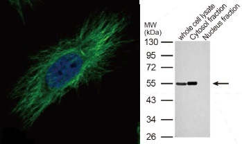 抗α-Tubulin抗体（#GTX102078）蛍光染色像とWB像