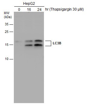 LAP（LC3-associated phagocytosis）関連抗体の使用例